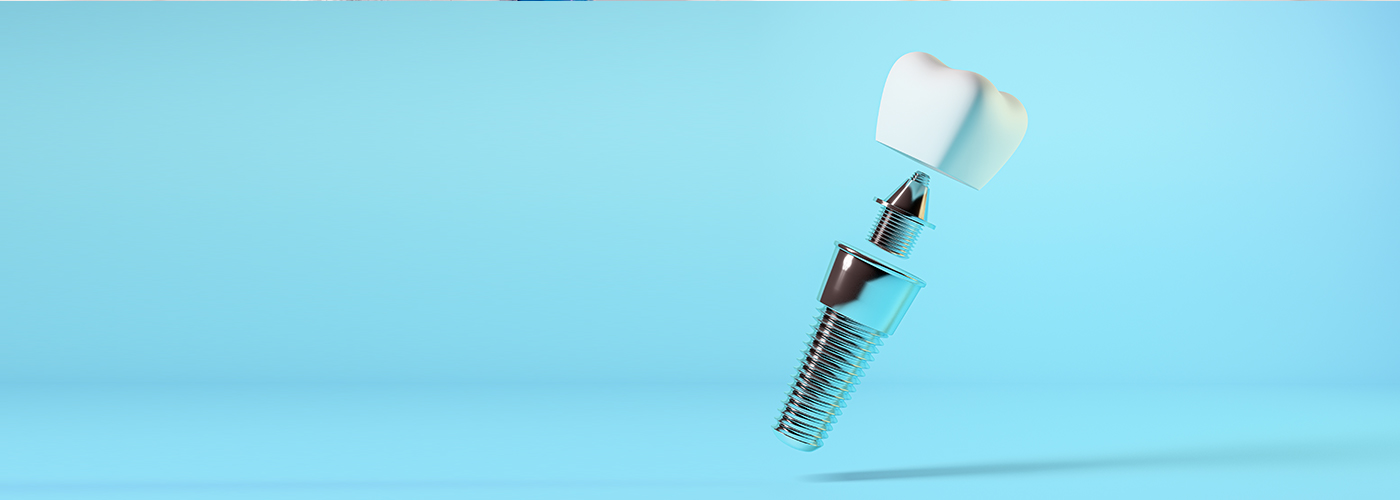 Dental Implants in Watertown, MA